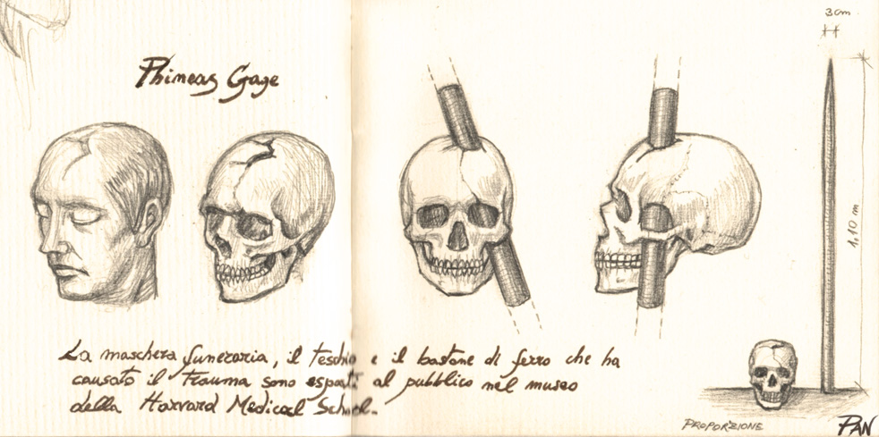 Phineas Gage studio cranio (dettaglio)